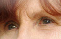 EMDR